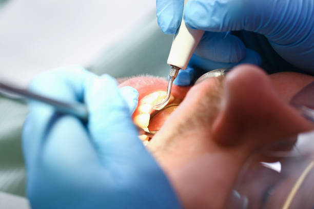 Best Tooth Pain Emergency Relief  in Henderson, LA