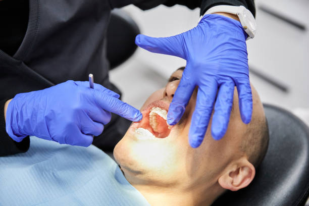 Best Broken Tooth Emergency  in Henderson, LA
